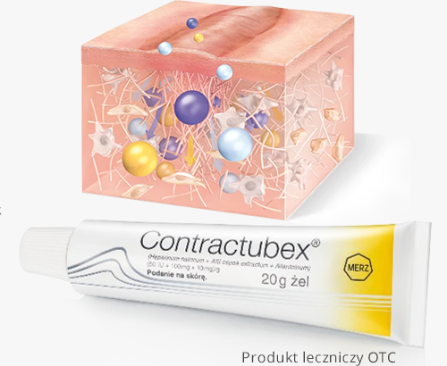 Contractubex - produkt leczacy blizny